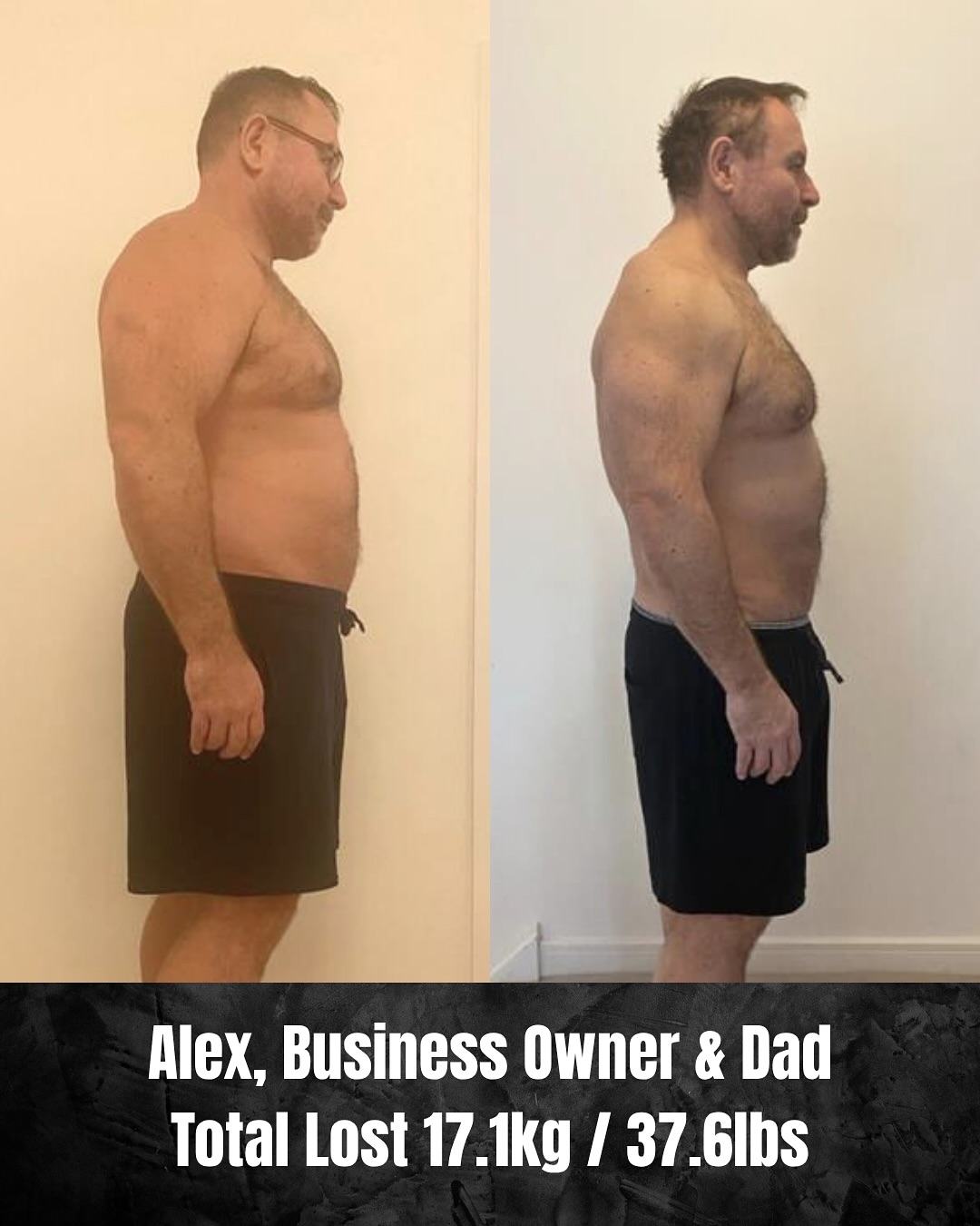 Alex's Transformation: 37 Lbs Shed Through Online Coaching