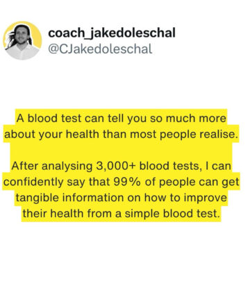 realted-article-image